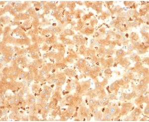 Formalin-fixed, paraffin-embedded human liver stained with Alpha-2-Macroglobulin Mouse Monoclonal Antibody (A2M/3621).