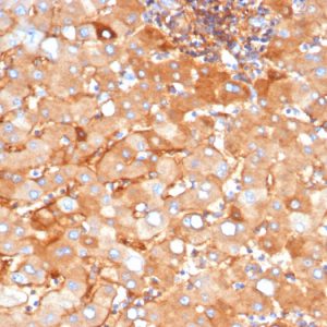 Formalin-fixed, paraffin-embedded human liver stained withAlpha-2-Macroglobulin Mouse Monoclonal Antibody (A2M/3622).