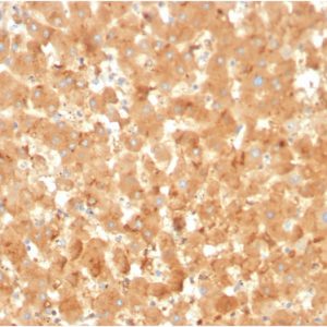 Formalin-fixed, paraffin-embedded human liver stained with Alpha-2-Macroglobulin Mouse Monoclonal Antibody (A2M/3623).