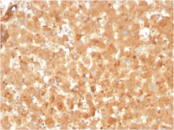 Formalin-fixed, paraffin-embedded human liver stained with Alpha-2-Macroglobulin Mouse Monoclonal Antibody (A2M/3623).