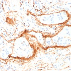 Formalin-fixed, paraffin-embedded human Small Intestine stained with Monospecific Mouse Monoclonal Antibody (ELN/1981) to Elastin.