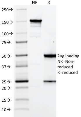 SDS-PAGE Analysis Purified Elastin Mouse Monoclonal Antibody (ELN/2069). Confirmation of Integrity and Purity of Antibody.