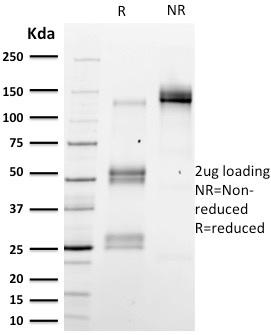 SDS-PAGE Analysis Purified Emerin Mouse Monoclonal Antibody (EMD/2167). Confirmation of Integrity and Purity of Antibody