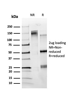 SSDS-PAGE Analysis. Purified ZBTB7C / KR-POK Mouse Monoclonal Antibody (PCRP-ZBTB7C-4E12). Confirmation of Purity and Integrity of Antibody.