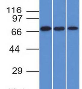 Western Blot of HeLa, A431 and HL-60 cell lysates with Endoglin / CD105 Monoclonal Antibody (ENG/1326).