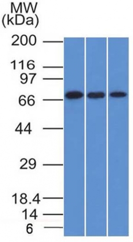 Western Blot of HeLa, A431 and HL-60 cell lysates with Endoglin / CD105 Monoclonal Antibody (ENG/1326).