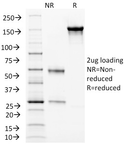 SDS-PAGE Analysis of Purified Endoglin / CD105 Monoclonal Antibody (ENG/1326). Confirmation of Integrity and Purity of Antibody