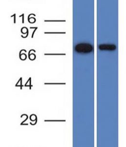 Western Blot of HeLa and A431 cell lysates with Endoglin / CD105 Mouse Monoclonal Antibody (ENG/1327).