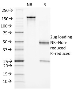 SDS-PAGE Analysis Purified Endoglin / CD105 Mouse Monoclonal Antibody (ENG/1327). Confirmation of Integrity and Purity of Antibody