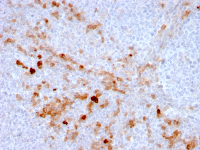 Formalin-fixed, paraffin-embedded human Tonsil stained with Endoglin / CD105 Mouse Monoclonal Antibody (ENG/3269). Endoglin / CD105 (Angiogenesis Marker) Antibody - Image 2