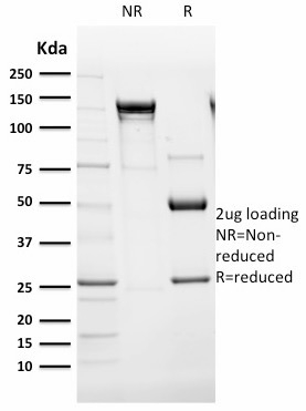 SDS-PAGE Analysis Purified Endoglin / CD105 Mouse Monoclonal Antibody (ENG/1621).Confirmation of Integrity and Purity of Antibody.
