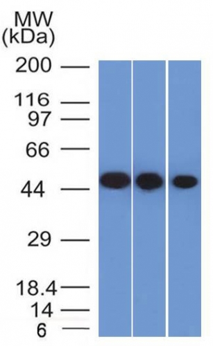 Western Blot of Y79, HeLa and HepG2 cell lysate using NSE, gamma Monoclonal Antibody (ENO2/1375).
