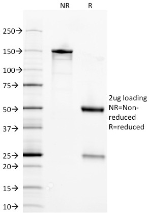 ENO2 Antibody in SDS-PAGE