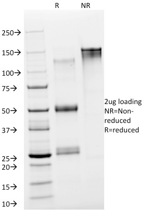 SDS-PAGE Analysis Purified NSE gamma Mouse Monoclonal Antibody (NSE-P2). Confirmation of Purity and Integrity of Antibody.