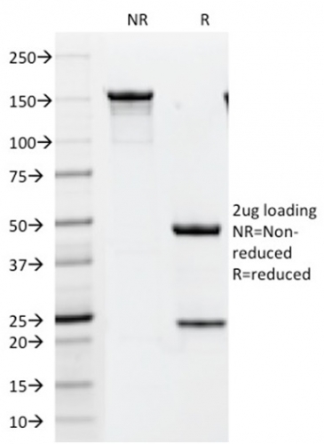 SDS-PAGE Analysis Purified HER-2 Monospecific Mouse Monoclonal Antibody (HRB2/451). Confirmation of Integrity and Purity of Antibody.