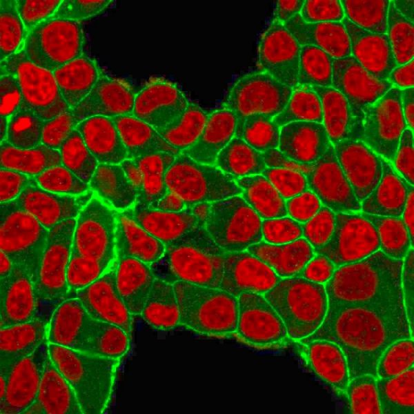 Immunofluorescent staining of PFA-fixed MCF-7 cells with HER-2 Monospecific Mouse Monoclonal Antibody (HRB2/451); followed by goat anti-mouse IgG-CF488 (Green). Nuclei are stained with Reddot (Red).