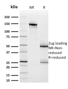 SDS-PAGE Analysis HER-2 Mouse Monoclonal Antibody (ERBB2/2453). Confirmation of Purity and Integrity of Antibody.