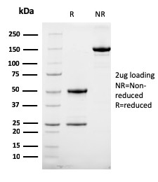 SDS-PAGE Analysis Purified HER-2 Mouse Monoclonal Antibody (HRB2/258). Confirmation of Integrity and Purity of Antibody.