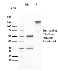 SDS-PAGE Analysis Purified HER-2 Mouse Monoclonal Antibody (ERBB2/3080). Confirmation of Purity and Integrity of Antibody.