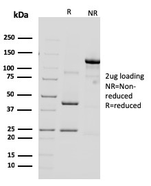 SDS-PAGE Analysis Purified HER-2 Mouse Monoclonal Antibody (ERBB2/3092). Confirmation of Purity and Integrity of Antibody.