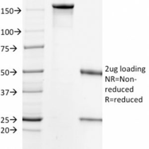 SDS-PAGE Analysis Purified HER-2 Mouse Monoclonal Antibody (HRB2/718). Confirmation of Integrity and Purity of Antibody.