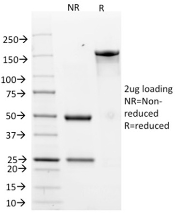 SDS-PAGE Analysis Purified HER-2 Mouse Monoclonal Antibody (HRB2/776). Confirmation of Integrity and Purity of Antibody.
