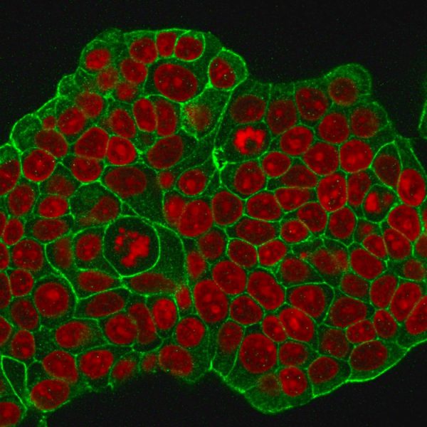 Immunofluorescent staining of MeOH-fixed MCF-7 cells with HER-2 Mouse Monoclonal Antibody (HRB2/776) followed by goat anti-Mouse IgG-CF488 (Green). Nuclei are stained with Reddot (Red).