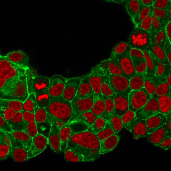 Immunofluorescent staining of PFA-fixed MCF-7 cells with HER-2 Mouse Monoclonal Antibody (HRB2/776) followed by goat anti-mouse IgG-CF488 (Green). Nuclei are stained with Reddot (Red).