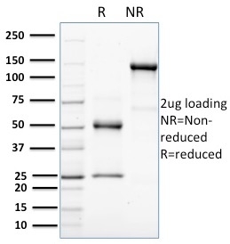 SDS-PAGE Analysis of Purified HER-4 / ERBB4 Mouse Monoclonal Antibody (HFR-1). Confirmation of Purity and Integrity of Antibody.