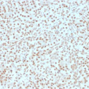 Formalin-fixed, paraffin-embedded human Pancreas stained with AKT1 Mouse Monoclonal Antibody (AKT1/2491).