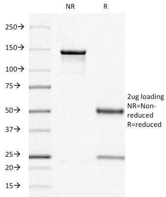 SDS-PAGE Analysis of Purified Estrogen Receptor alpha Mouse Monoclonal Antibody (ER505). Confirmation of Integrity and Purity of Antibody.