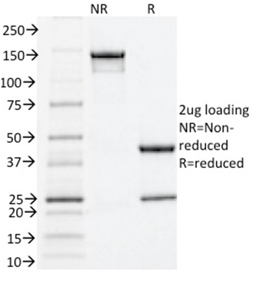 SDS-PAGE Analysis Purified Estrogen Receptor alpha Mouse Monoclonal Antibody (ESR1/1935). Confirmation of Integrity and Purity of Antibody.