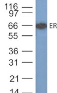Western Blot Analysis of Estrogen Receptor in MCF-7 cell lysate using Estrogen Receptor Ab (SPM567).
