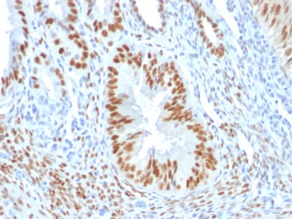 Formalin-fixed, paraffin-embedded human Endometrium stained with Estrogen Receptor alpha Mouse Monoclonal Antibody (ER506).