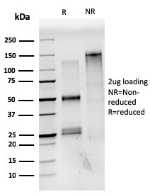 SDS-PAGE Analysis of Purified Estrogen Receptor alpha Mouse Monoclonal Antibody (ESR1/3559). Confirmation of Integrity and Purity of Antibody.