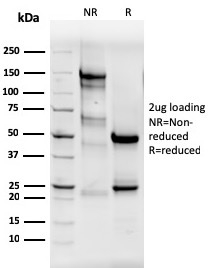 ESR1 Antibody in SDS-PAGE.