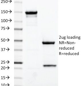 SDS-PAGE Analysis of Purified Estrogen Receptor Mouse Monoclonal Antibody (ESR1/420). Confirmation of Integrity and Purity of Antibody.
