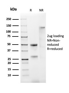 SDS-PAGE Analysis Purified ER, alpha Rabbit Recombinant Monoclonal Antibody (ESR1/2299R). Confirmation of Purity and Integrity of Antibody.