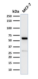 SDS-PAGE Analysis of Purified ER, alpha Rabbit Recombinant Monoclonal Antibody (ESR1/2299R). Confirmation of Purity and Integrity of Antibody.