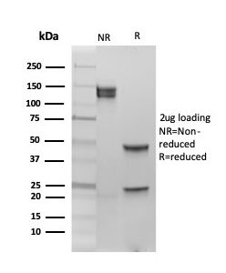SDS-PAGE Analysis of Purified ER-beta1 Mouse Monoclonal Antibody (PPG5/10). Confirmation of Integrity and Purity of Antibody.