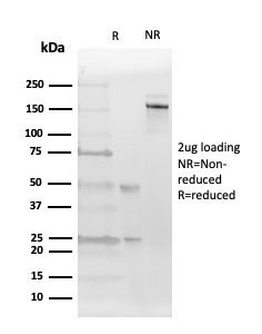 Estrogen Receptor beta 1 Antibody in SDS-PAGE.