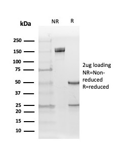 SDS-PAGE Analysis of Purified ER-beta5 Mouse Monoclonal Antibody (PPG5/25). Confirmation of Integrity and Purity of Antibody.