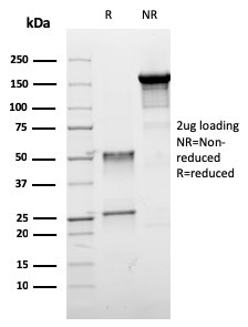 SDS-PAGE Analysis of Purified ER-beta Mouse Monoclonal Antibody (ESR2/3005). Confirmation of Purity and Integrity of Antibody.