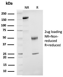 SDS-PAGE Analysis of Purified ER-beta Mouse Monoclonal Antibody (ESR2/3207). Confirmation of Purity and Integrity of Antibody.