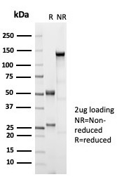 SDS-PAGE Analysis of Purified ER-beta Recombinant Rabbit Monoclonal Antibody (ESR2/7006R). Confirmation of Purity and Integrity of Antibody.