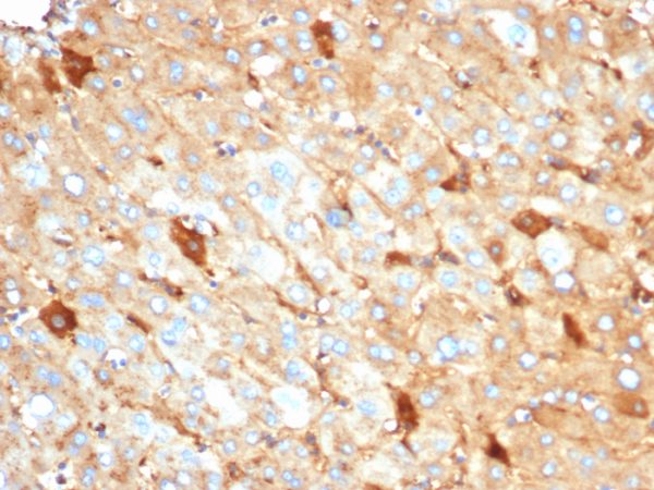 Formalin-fixed, paraffin-embedded human liver stained with Albumin Recombinant Mouse Monoclonal Antibody (rALB/6410).