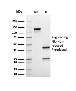 SDS-PAGE Analysis of Purified Albumin Recombinant Mouse Monoclonal Antibody (rALB/6410). Confirmation of Purity and Integrity of Antibody.