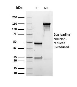SDS-PAGE Analysis of Purified Albumin Recombinant Mouse Monoclonal Antibody (rALB/6412). Confirmation of Purity and Integrity of Antibody.