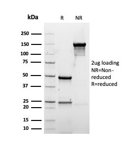 SDS-PAGE Analysis of Purified Albumin Recombinant Mouse Monoclonal Antibody (rALB/6412). Confirmation of Purity and Integrity of Antibody.