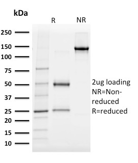 SDS-PAGE Analysis of Purified Albumin-Monospecific Mouse Monoclonal Antibody (ALB/2142). Confirmation of Integrity and Purity of Antibody.